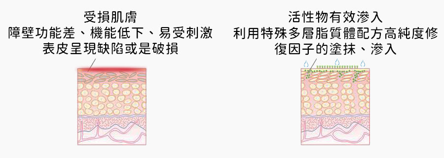 如何修復角質層？皮膚科醫生教你高效重建屏障肌膚